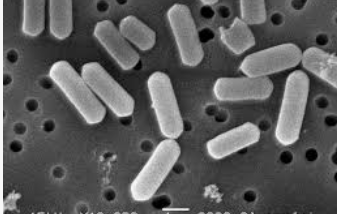 【社会】京都のホテルで修学旅行中の中学生ら106人が腹痛など発症　ウエルシュ菌「集団食中毒」断定