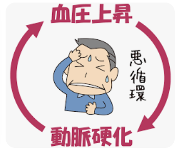 【医療】高血圧治療の目標値、７５歳以上で「上１３０・下８０未満」に…１０引き下げで脳卒中などの予防に