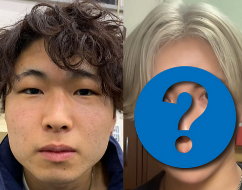 【美容整形】異性からの陰口に「整形で見返してやる」 200万で「K-POPアイドル」並のイケメンになった男性「整形は人生を取り戻す手段」