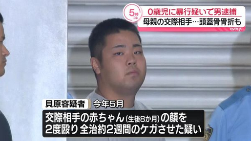 【東京】生後8カ月の赤ちゃんの顔を殴りけがさせたか、21歳男を逮捕「ごみ箱のごみを口に含もうとするのでやめさせようとしたが、言うことを聞かずイライラした」