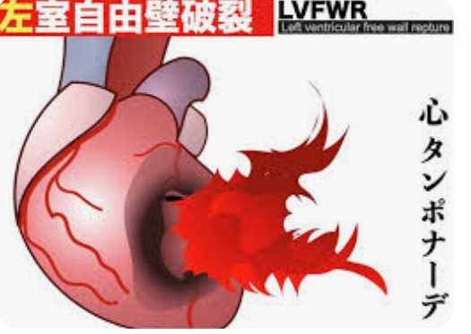 【徳島】集合住宅で男性が死亡　死因は「心臓破裂」警察が調べ