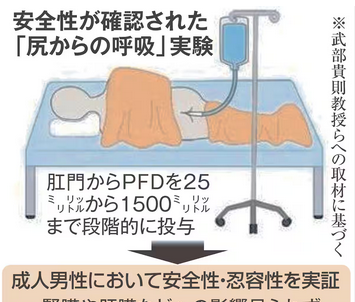 【腸換気法】「お尻呼吸」が肺治療に革命か　イグ・ノーベル賞の研究者らが人での実験で安全性を確認