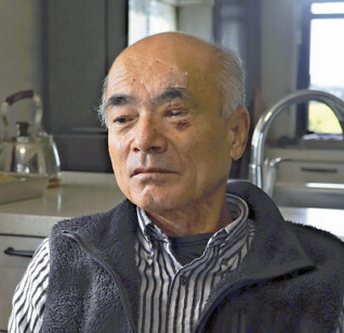 【富山市】クマに顔引き裂かれ、神経・筋肉失い手術５回…後遺症に苦しむ男性「駆除しないと」「かわいそうとは思わないよ」