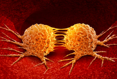 【医療】がん細胞だけ壊す特殊なウイルスで食道がん治療、初の薬を岡山大発新興企業が申請…抗がん剤治療を代替する可能性も
