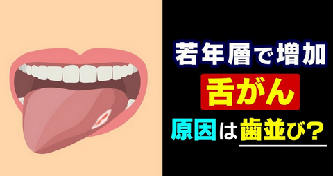 【健康】20年で倍増…増える若年層の「舌がん」 現代人特有の “狭い歯並び” が引き金に? 口内炎との決定的な違いとは