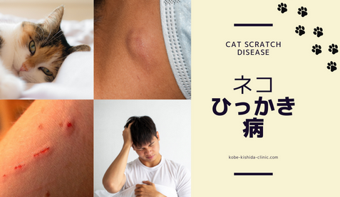 【猫ライフ】年１万人感染「猫ひっかき病」にご注意…研究者ら「むやみに野良猫を触らない」「飼い猫を外に出さない」