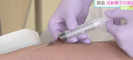 中国の診療所、1本の注射針を15人に使い回して採血　さすが新型コロナ発祥の地